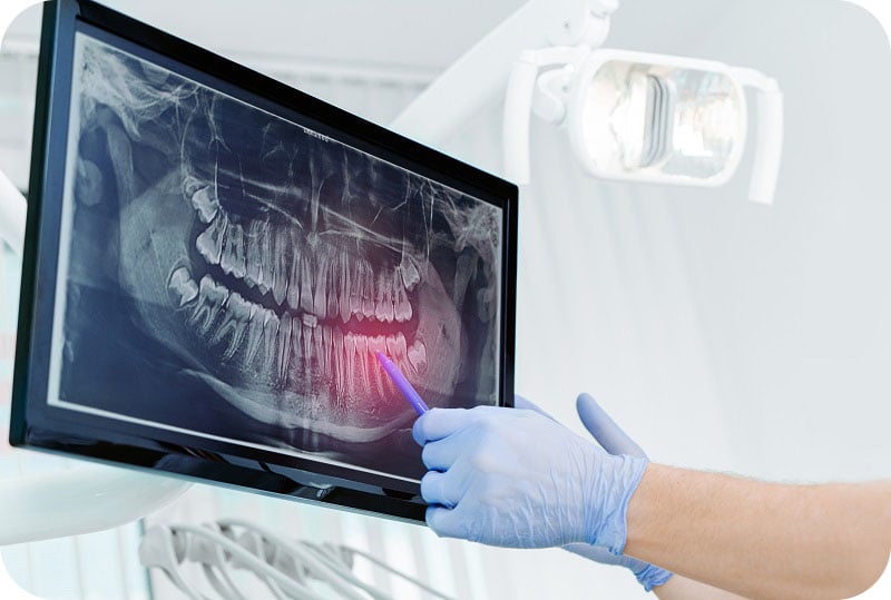 Examining an X-ray image